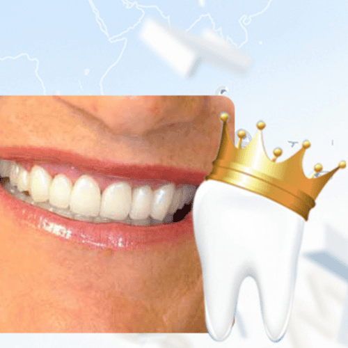 Dental Crowns in Cali, Colombia: Comprehensive Guide on Costs, Types & Benefits
